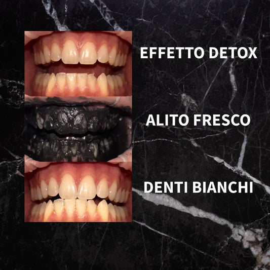 Kit: Polvere+Strisce+ Spazzolino