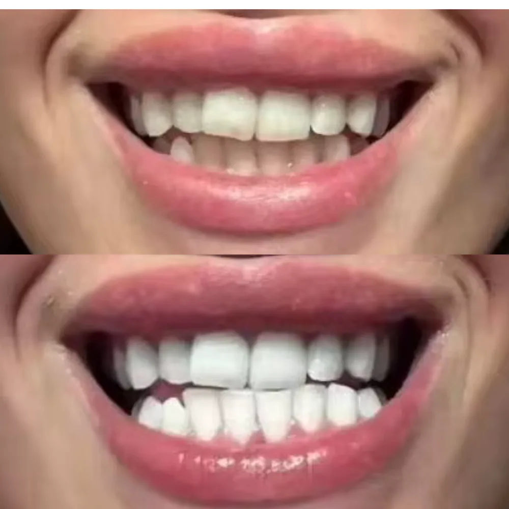 Perché i denti diventano gialli: cause e come intervenire