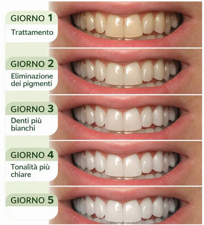 Kit Sbiancante: Polvere +Strisce PAP+