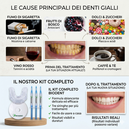 Kit Sbiancante Denti Professionale con lampada LED